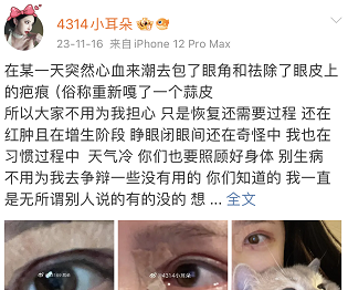 小耳朵心血来潮做双眼皮手术，月薪三千流下不争气眼泪  第4张