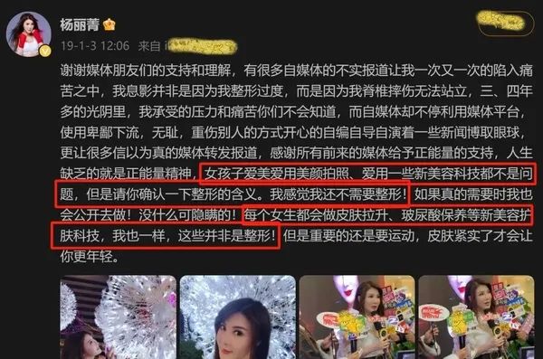 55岁功夫女神复出拍戏，“科技脸”又僵又肿，今昔对比判若两人  第4张